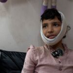 Severe injuries change 12-year-old Mazyouna’s life in Gaza