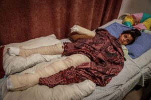 ‘Between pain and fear’: Gaza children bear cost of ongoing Israeli attacks
